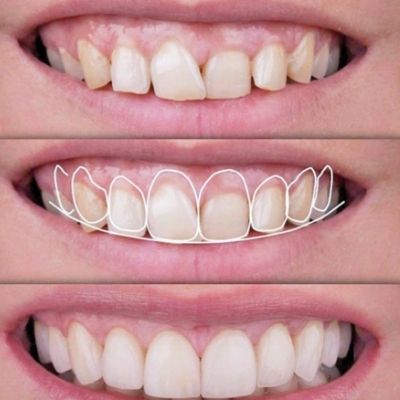 Estética restauradora